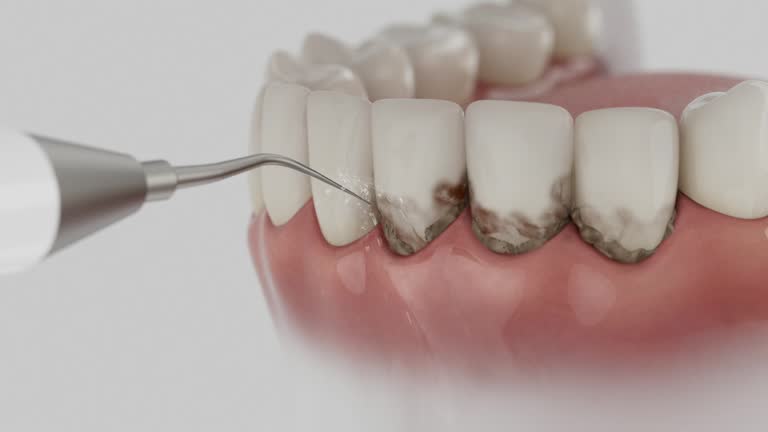 Reliable Teeth Cleaning And Checkup contractor in Brantley County County, GA by Dentist Open Now